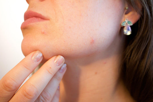 Glutathione vs. Vitamin C: Which Is Better for Skin Brightening in Pakistan?